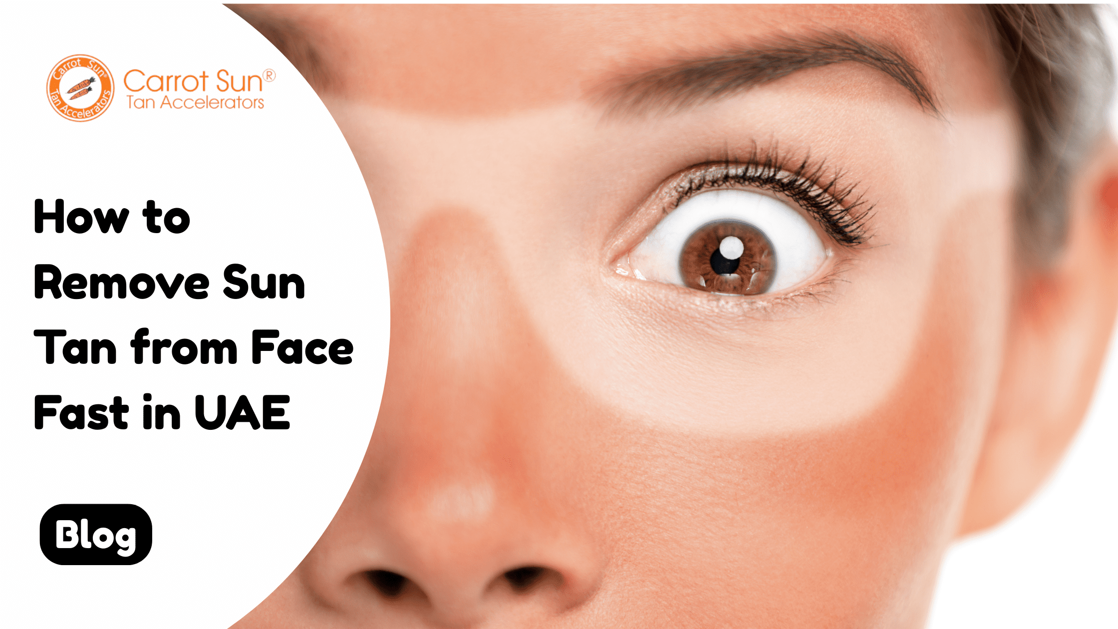 How to Remove Sun Tan from Face