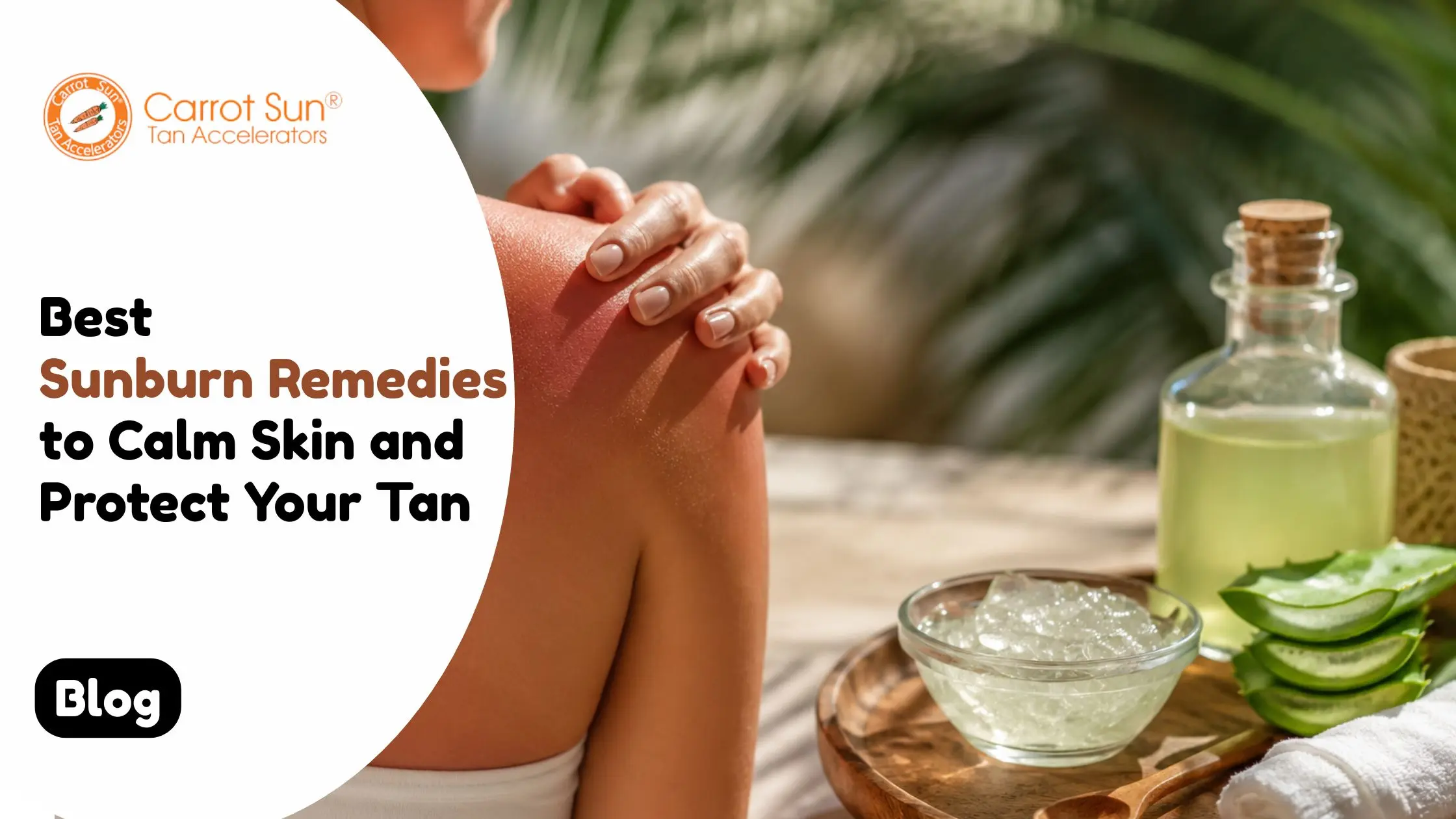 Best Sunburn Remedies to Calm Skin and Protect Your Tan